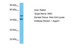 WAC Rabbit anti-Human, Polyclonal, Novus Biologicals 0.1 mL | Buy Online | Novus Biologicals | Fisher Scientific